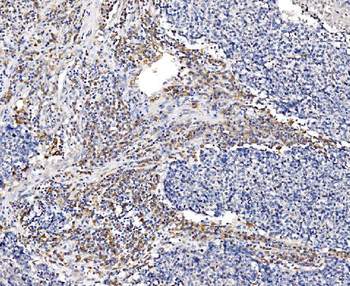 GFPT1 Antibody