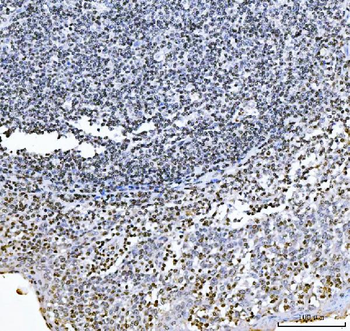 GADD45B Rabbit Polyclonal Antibody