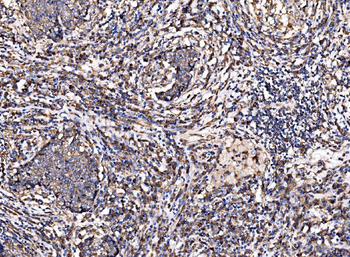 G3BP/G3BP1 Antibody