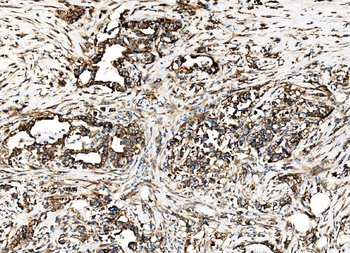 G3BP/G3BP1 Antibody
