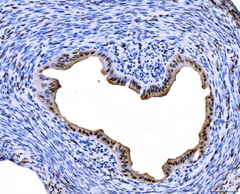 FOXL2 Rabbit Polyclonal Antibody