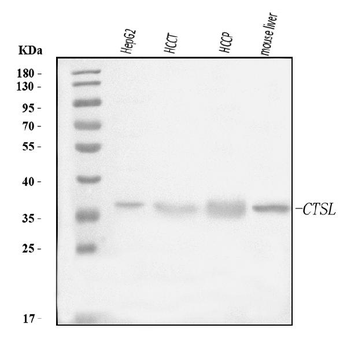 Cathepsin L/MEP/CTSL Rabbit Polyclonal Antibody