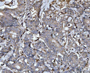 Cathepsin B/CTSB Antibody