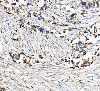 CPT1A Rabbit Polyclonal Antibody