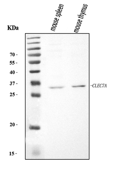 Dectin-1/Clec7a Rabbit Polyclonal Antibody