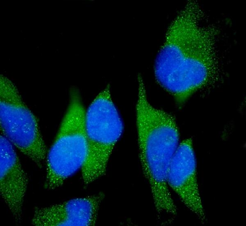 Claudin18/CLDN18 Rabbit Polyclonal Antibody
