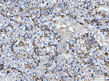 CD14 Antibody