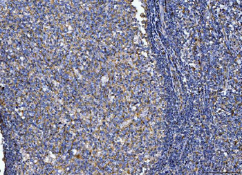 CD14 Antibody