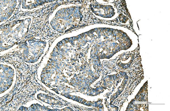 CD9 Rabbit Polyclonal Antibody