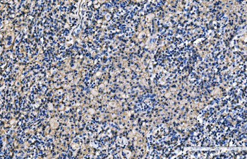 CD9 Rabbit Polyclonal Antibody
