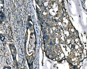 ATP6V1A Antibody