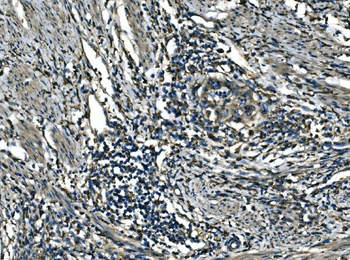 ATP6V1A Antibody