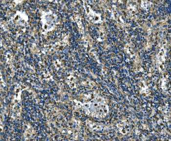 ATP6V1A Antibody