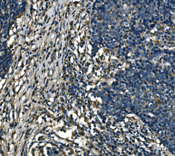 ATP6V1A Antibody