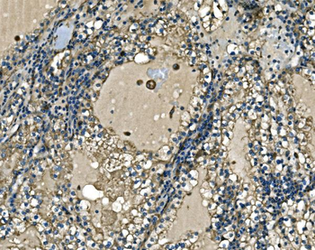 ATP6V1A Antibody