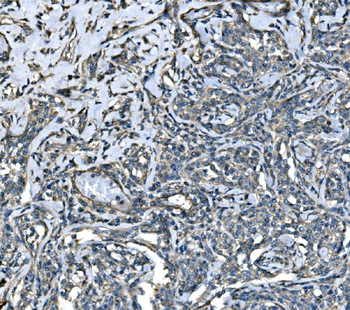 SPG3A/ATL1 Rabbit Polyclonal Antibody