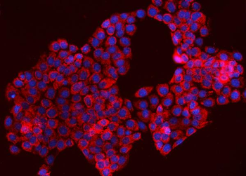 TOMM70 Antibody