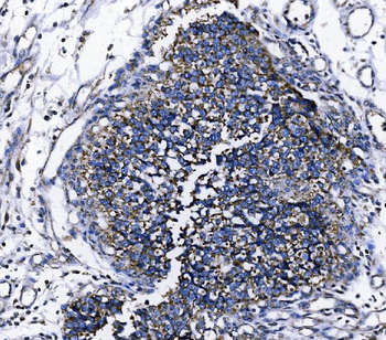 TOMM70 Antibody