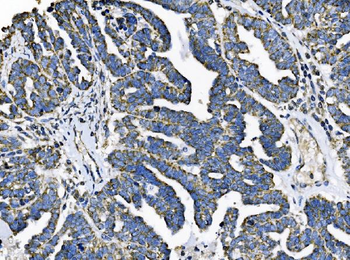 TOMM70 Antibody