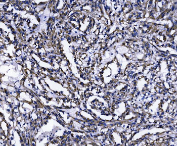 TOMM70 Antibody