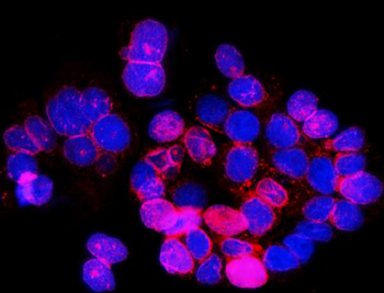 SUN2 Antibody