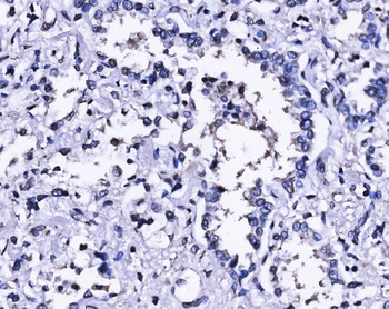 SUN2 Antibody