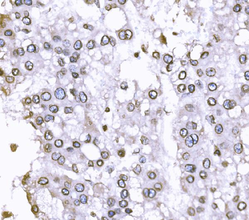 SUN2 Antibody