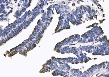 SUN2 Antibody