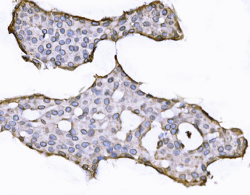 SUN2 Antibody