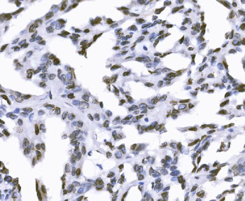 SUN2 Antibody