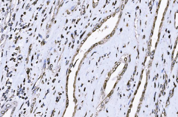 SUN2 Antibody