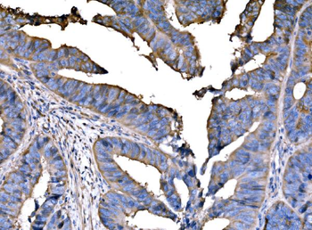 PPFIA1 Antibody
