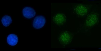 NPL4/NPLOC4 Rabbit Polyclonal Antibody