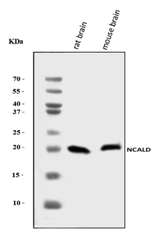 NCALD Rabbit Polyclonal Antibody