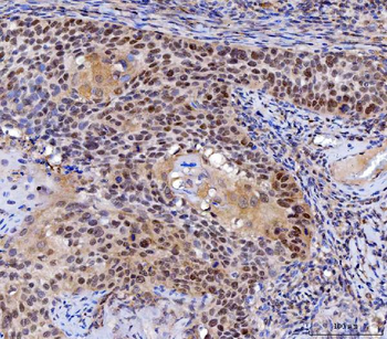 MLH1 Antibody