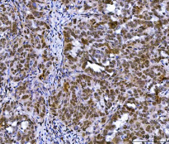MLH1 Antibody