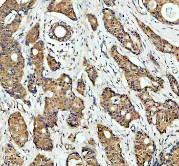 p38 alpha/MAPK14 Rabbit Polyclonal Antibody