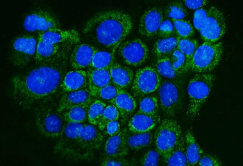 Glutaredoxin 1/GLRX Antibody