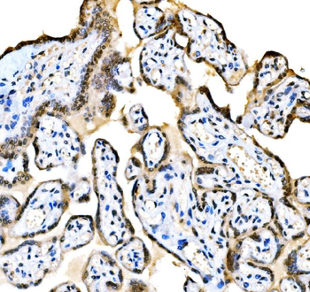 KAT3B/p300/EP300 Antibody