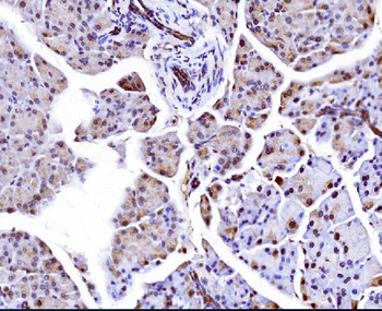 Elongin-C/ELOC Antibody
