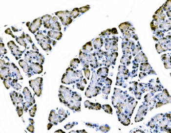 Elongin-C/ELOC Antibody