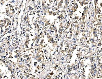 Elongin-C/ELOC Antibody