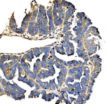 Elongin-C/ELOC Antibody