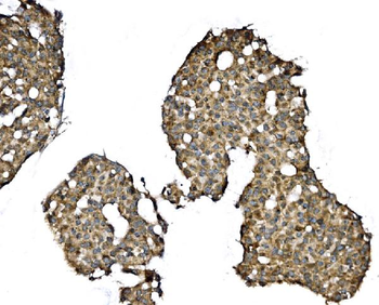 Elongin-C/ELOC Antibody
