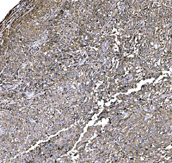 Elongin-C/ELOC Antibody
