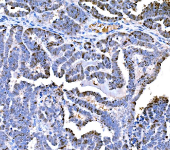 DPY19L1 Rabbit Polyclonal Antibody