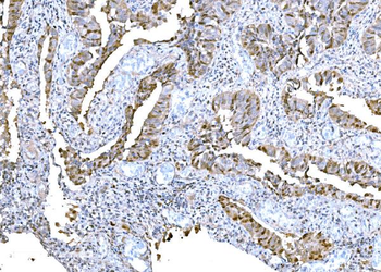 DPY19L1 Rabbit Polyclonal Antibody