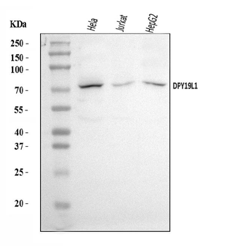 DPY19L1 Rabbit Polyclonal Antibody