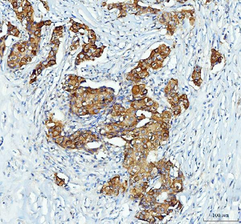 XTP3TPA/DCTPP1 Antibody