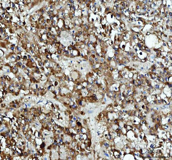 XTP3TPA/DCTPP1 Antibody